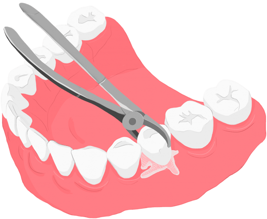 Удаление зубов под наркозом Томск Малиновая алексеева татьяна томск стоматология